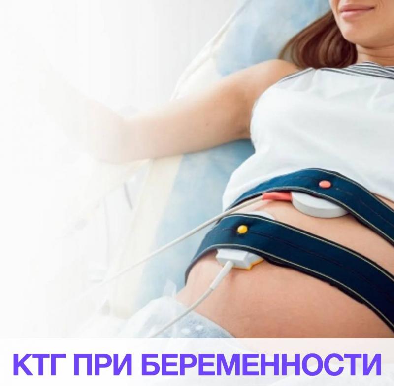 КТГ (КАРДИОТОКОГРАФИЯ)