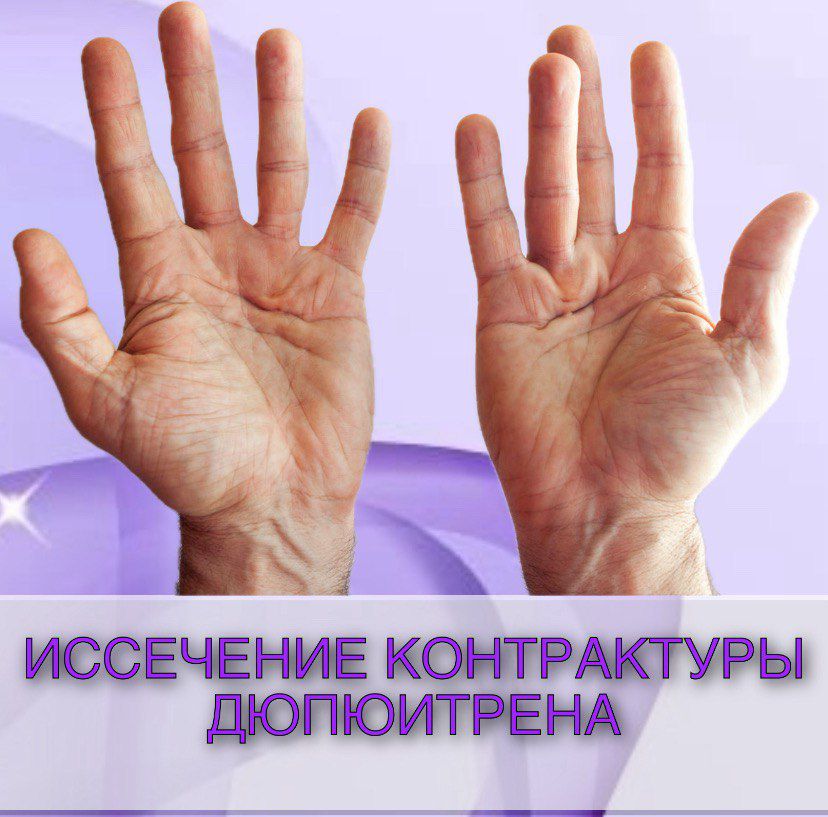 e1545fff-3372-4d2d-975f-239d19c8b0b7.jpg